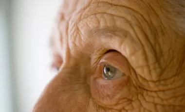 vieillisement peau personnes agees
